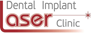 Dental Implant Laser Clinic